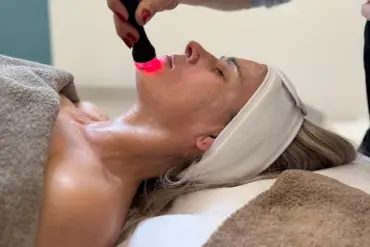 Microneedling con Tango Serum