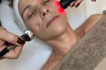 Microneedling PhiBright