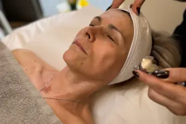 Microneedling PhiBright